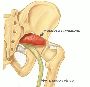 Sintomas y diagnostico del Musculo Piriforme o piramidal